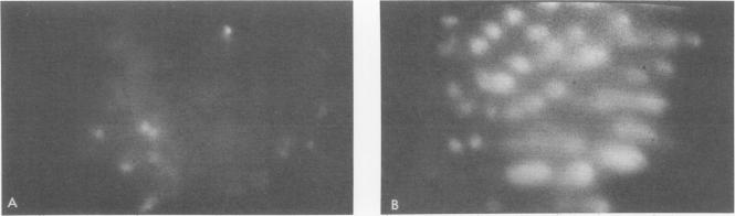 Figs. 2A and B.