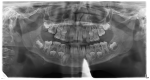 Figure 28
