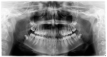 Figure 36