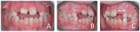 Figure 30