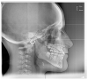 Figure 20