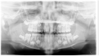 Figure 23