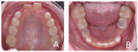 Figure 31