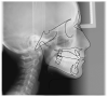 Figure 37