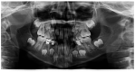 Figure 32