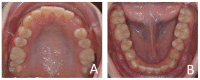 Figure 35