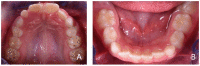 Figure 22