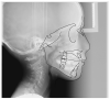 Figure 33