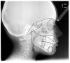 Figure 29