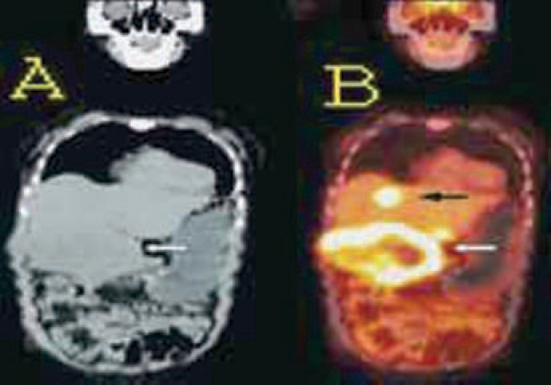 Fig. 2