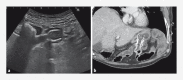Fig. 4