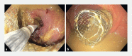 Fig. 3