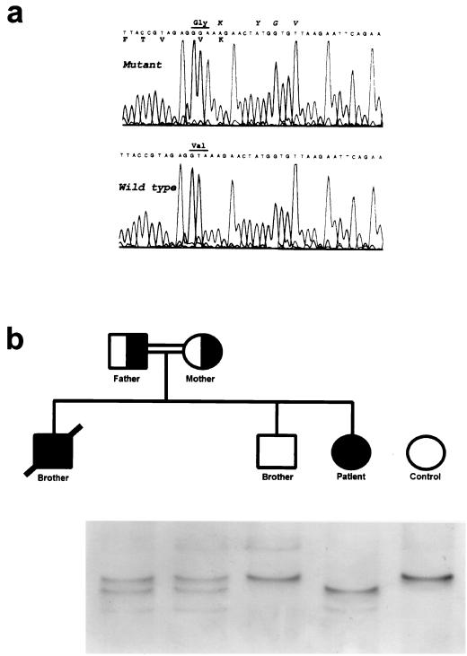 FIG. 1