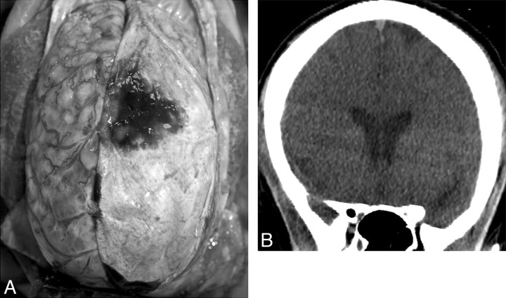 Fig 4.