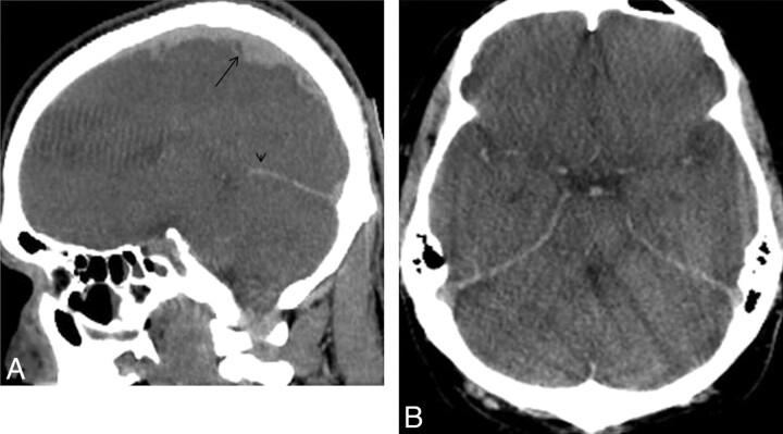 Fig 2.