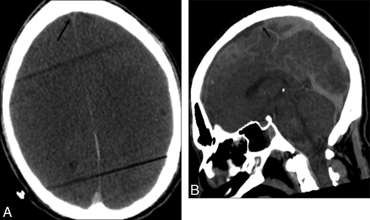 Fig 6.