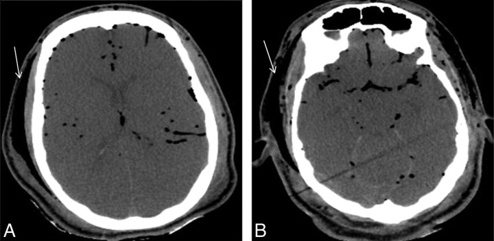 Fig 8.