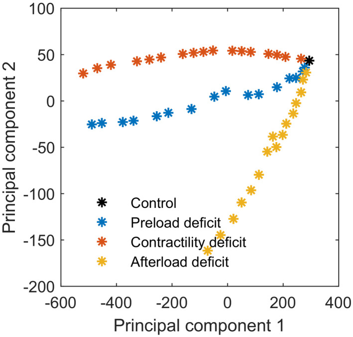 Distinct morphologies of arterial waveforms reveal preload ...