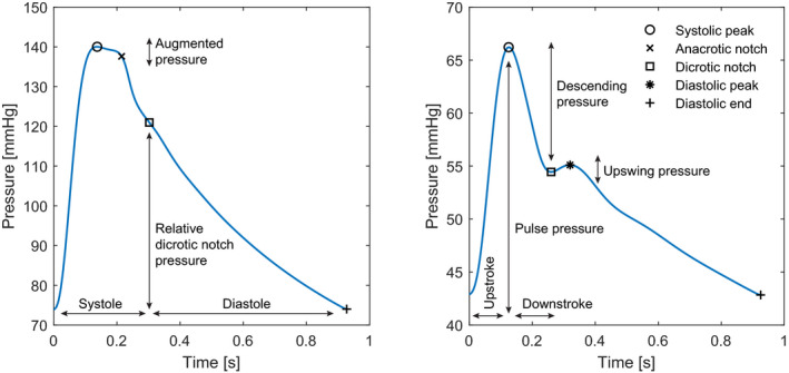 Distinct morphologies of arterial waveforms reveal preload ...