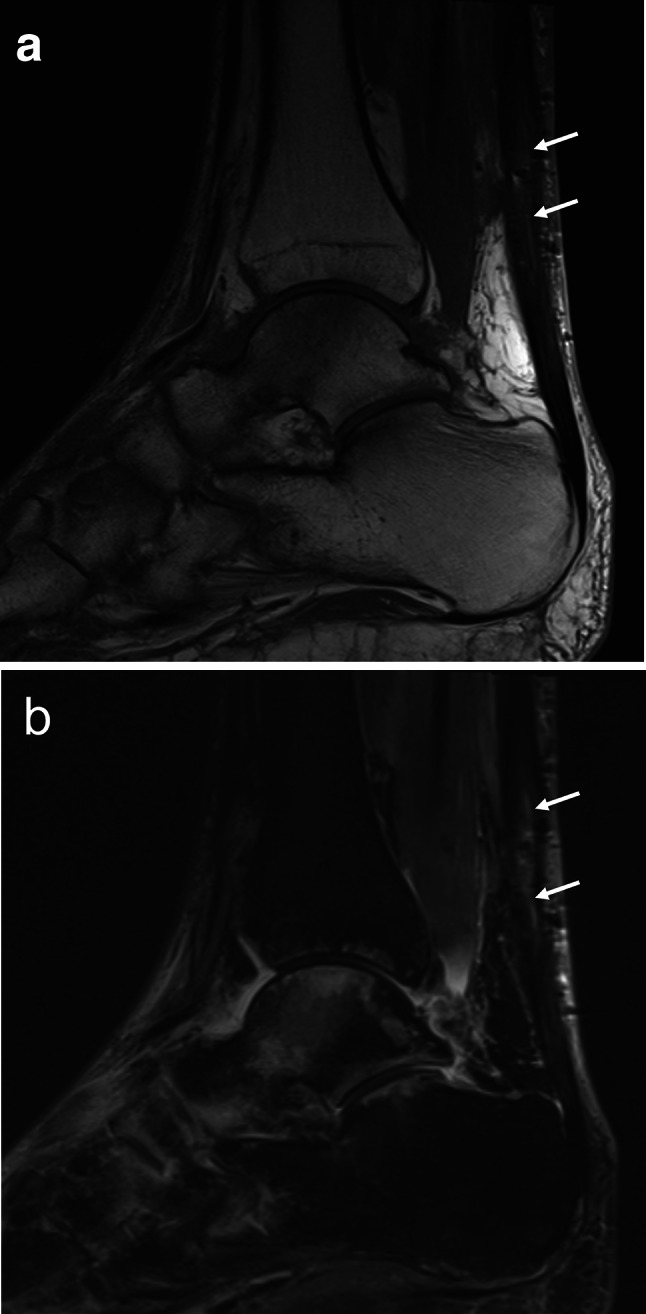 Fig. 7
