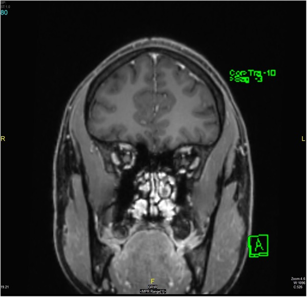 Figure 7