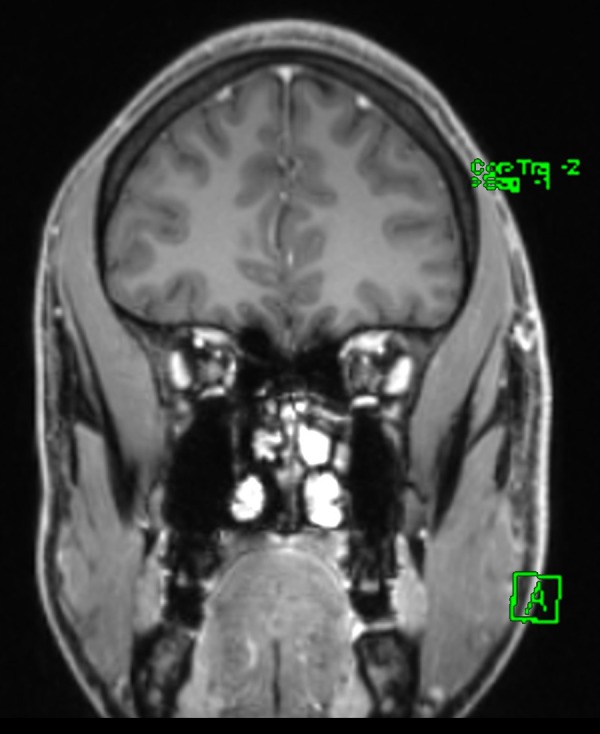 Figure 3