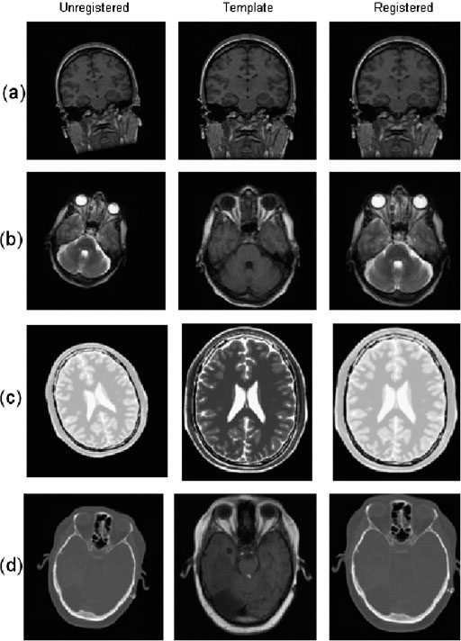 Fig. 12