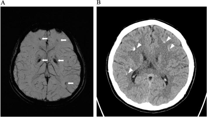 Fig. 2