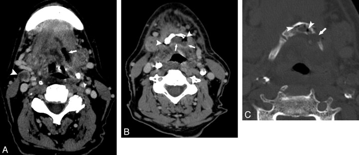 Fig 2.