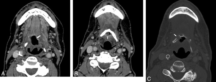 Fig 3.