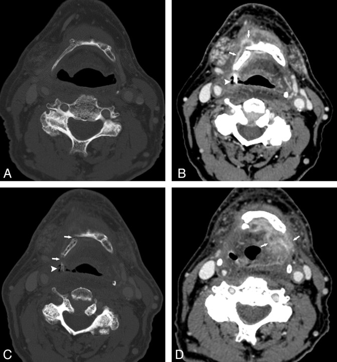 Fig 4.