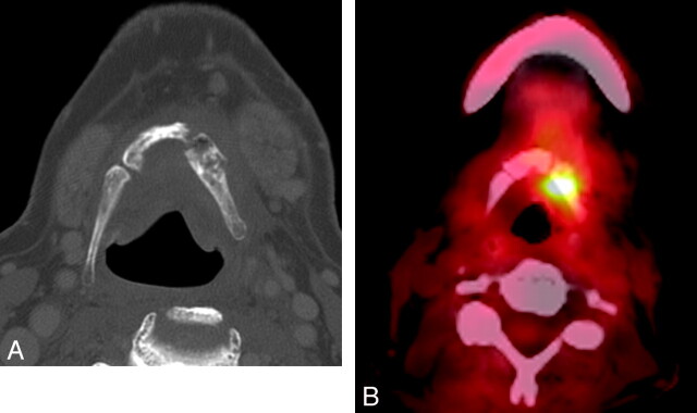 Fig 5.