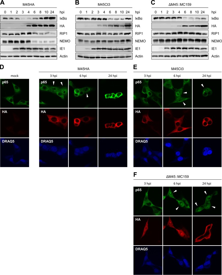 FIG 3