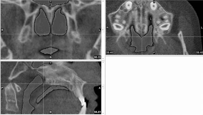 Figure 3.