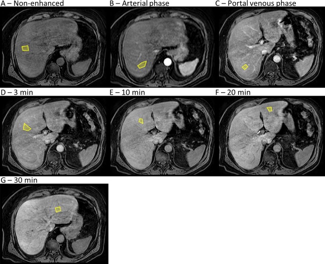 Fig 5