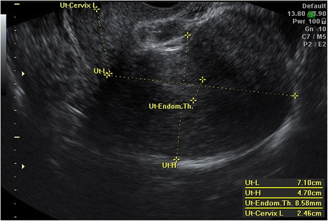 Fig. 1
