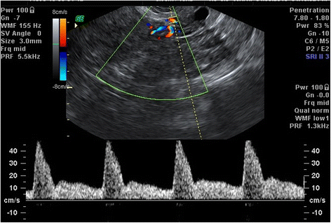 Fig. 2