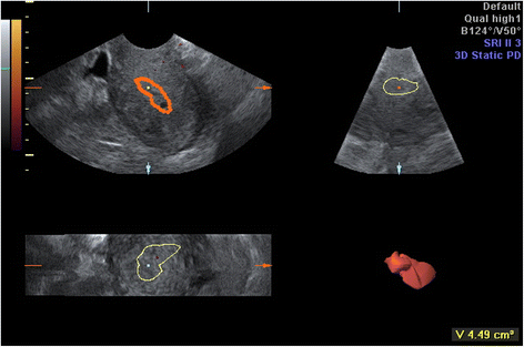 Fig. 3