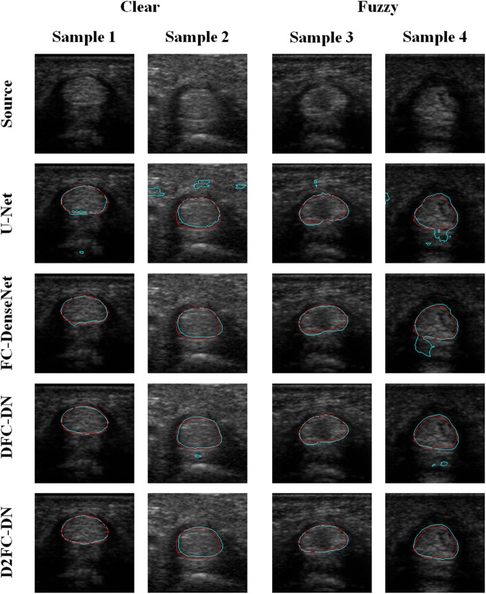 Fig. 4