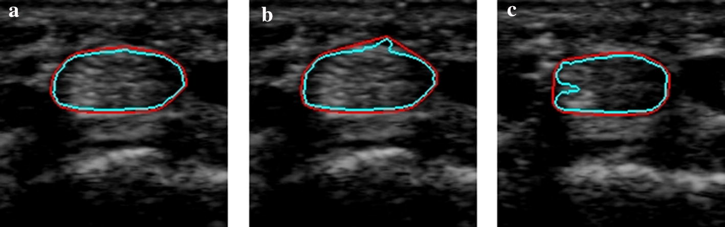 Fig. 3