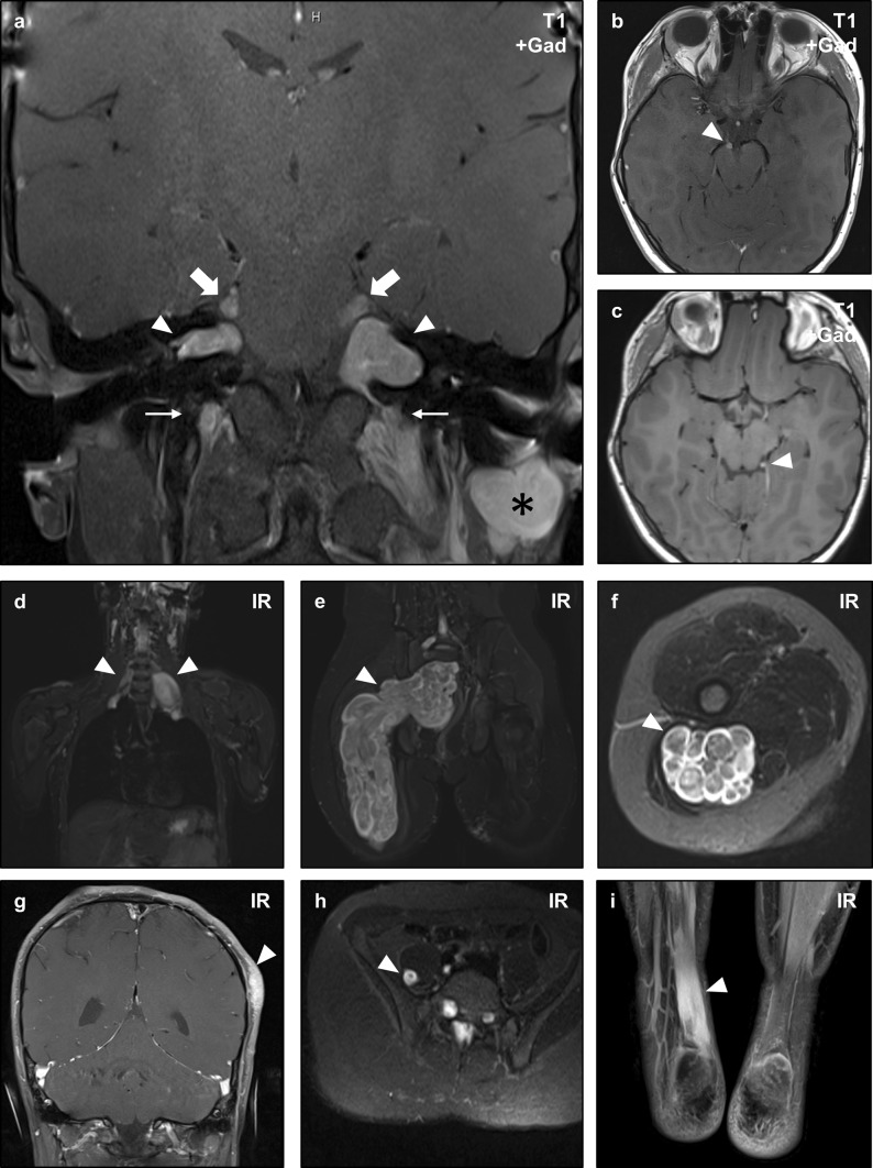 Fig. 3