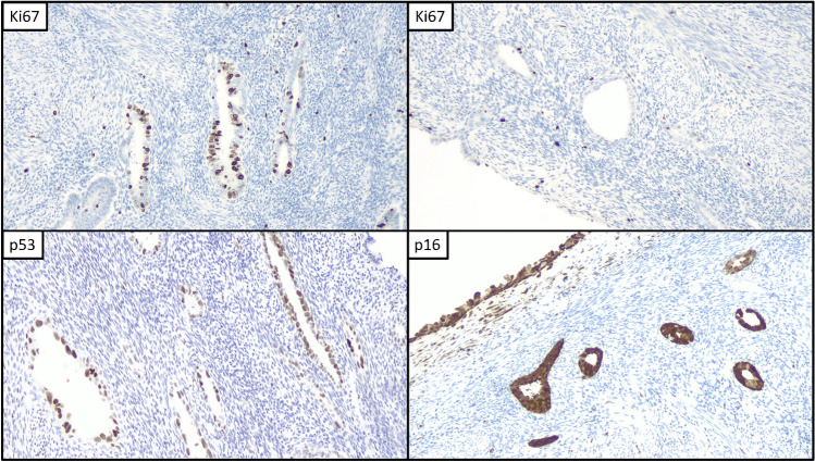 Fig. 2