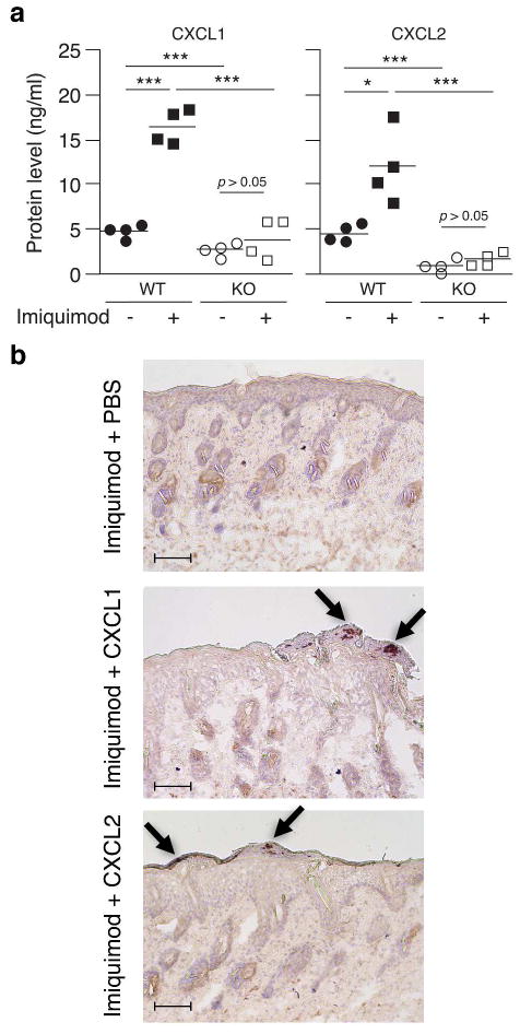 IL-1R1 signaling facilitates Munro’s microabscess formation in ...