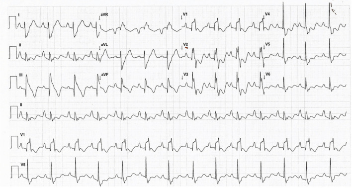 Fig. 2