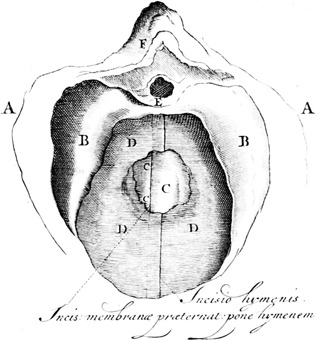 Figure 21