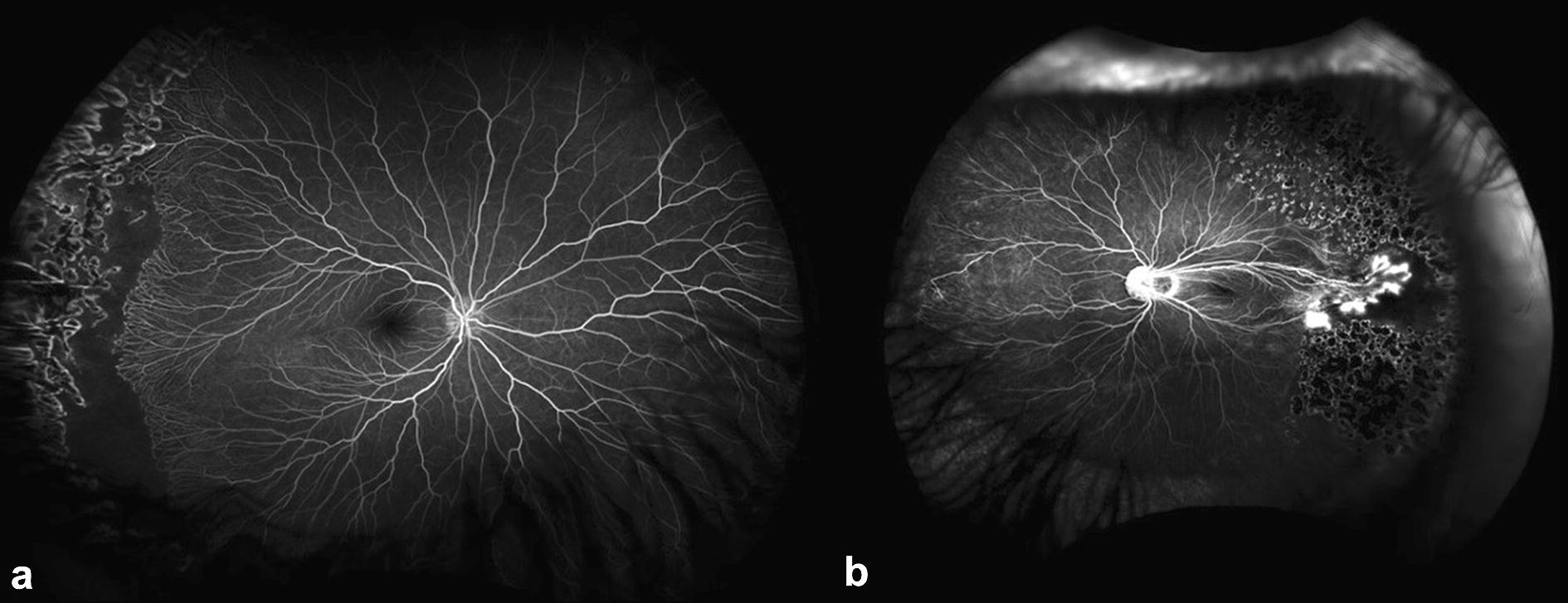 Fig. 1