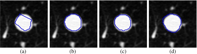 Fig. 15