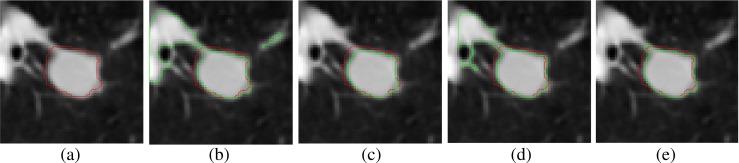 Fig. 17