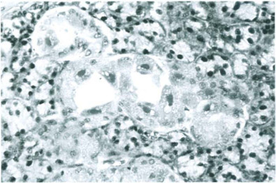 Fig. 12-14