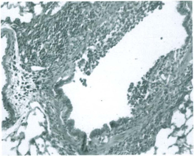 Fig. 12-27